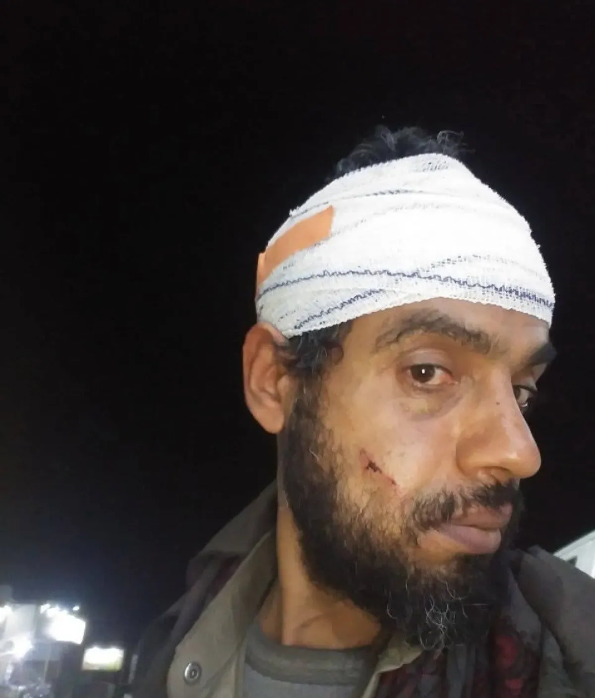 صنعاء..مواطن يكشف تعرضه وطفله لاعتداء ويتهم الأمن بإجباره على التنازل