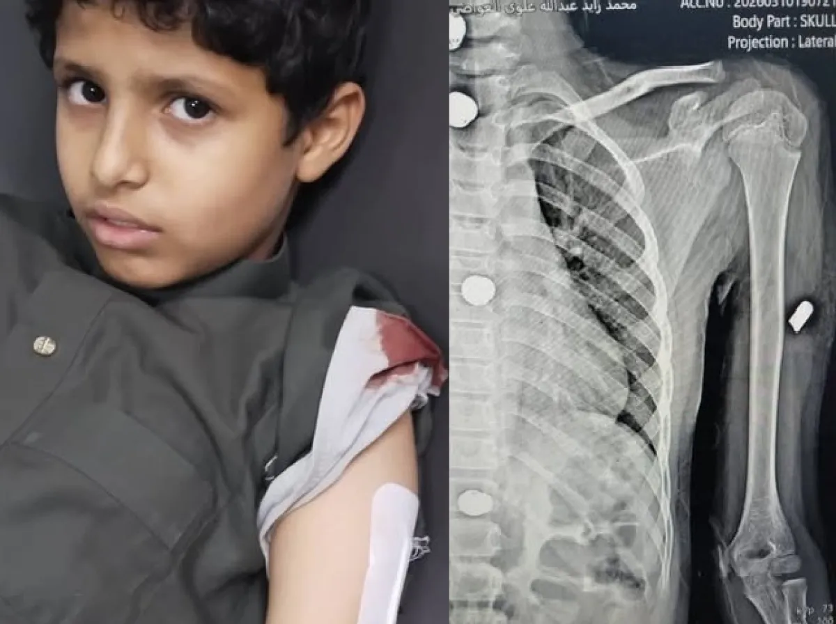 إصابة امرأتين وطفل جراء اشتباكات بين جنود في عتق بشبوة