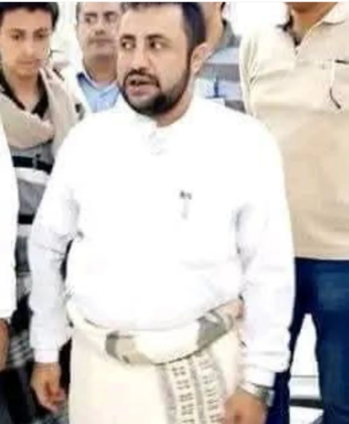 العطاب لوزير صحة صنعاء: مستشفى الثورة بحاجة إلى قيادة كفؤة لا إلى شخص بمؤهل دبلوم صحي