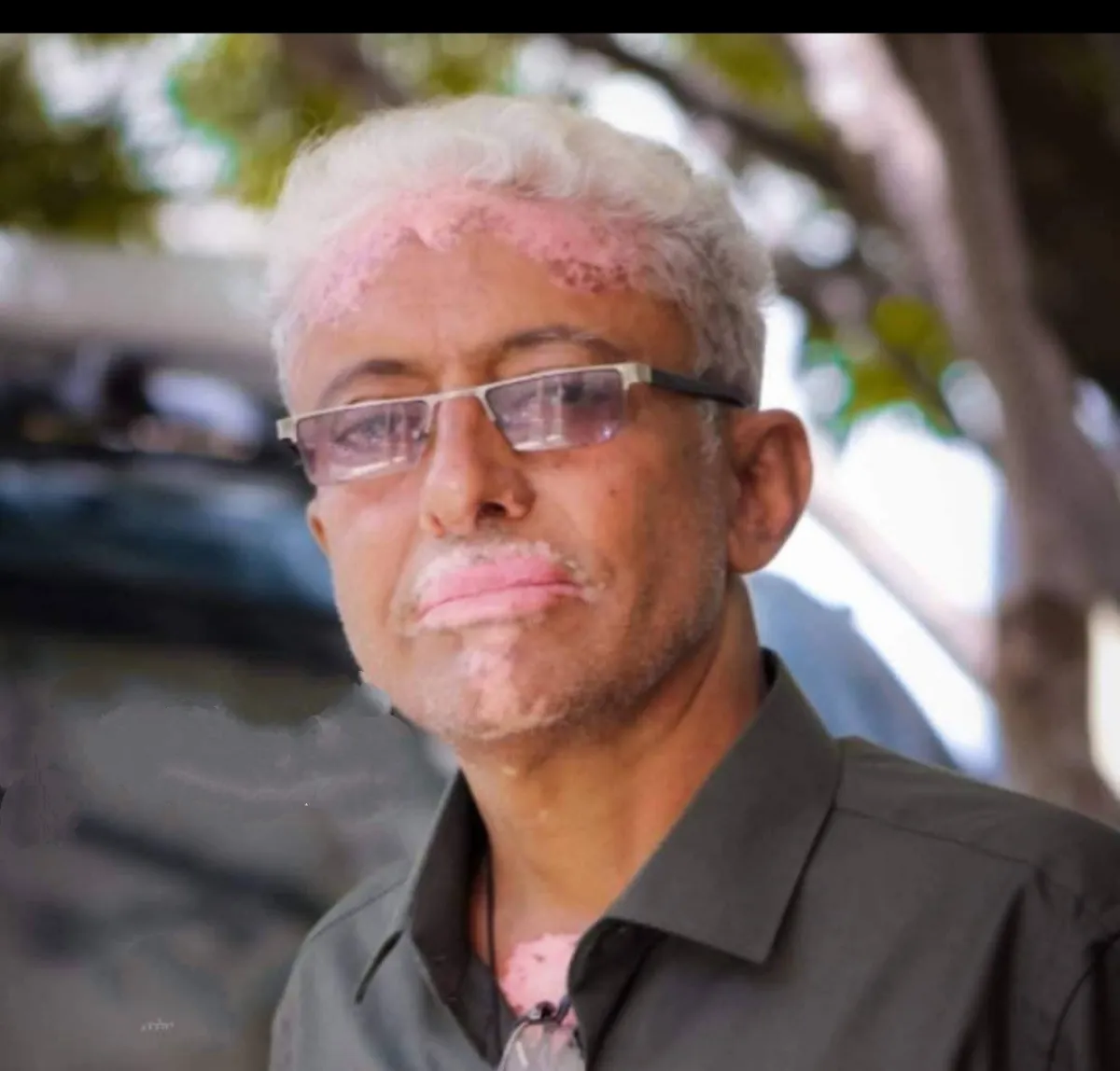 ناشط يحذر من فساد مستشر في مستشفيات تعز الحكومية