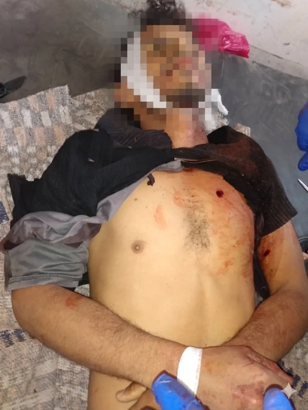 مقتل شاب في القبيطة بلحج في خلاف على قطعة أرض