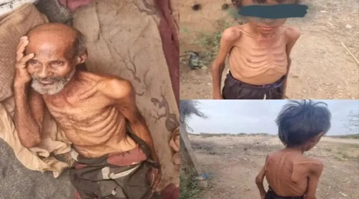 وفاة مسن وطفل جوعاً داخل مخيم نزوح في حجة