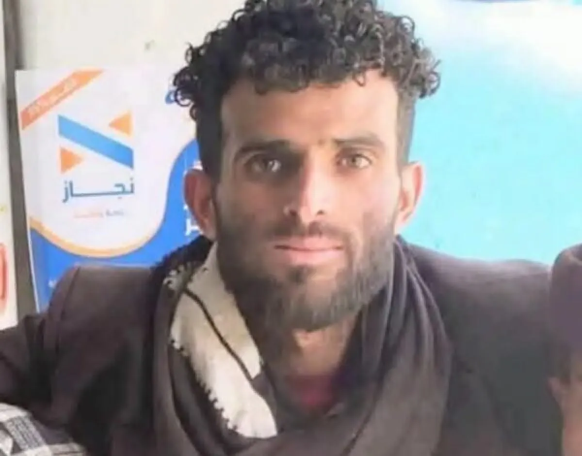 وفاة شاب في إب عقب تعرضه للتعذيب
