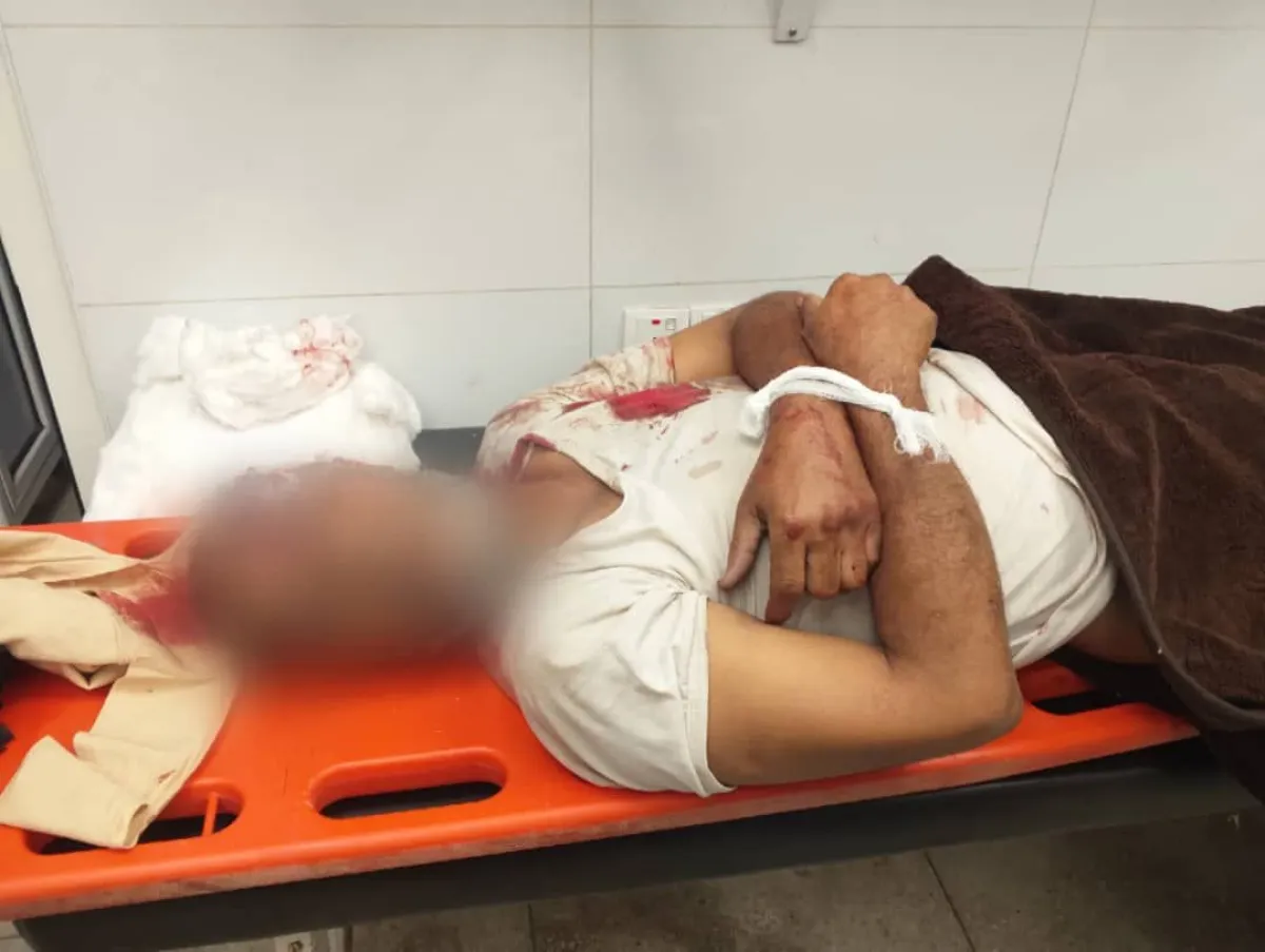 الأمم المتحدة: مقتل وإصابة 262 مدنياً في اليمن منذ أغسطس